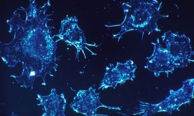 Doctors Found A Fantastic Method To Destroy Cancer Cells